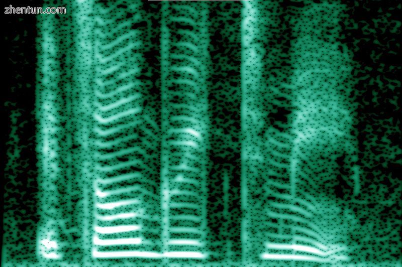 The spectrogram of the human voice reveals its rich harmonic content.