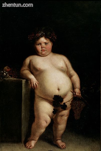 A 1680 painting by Juan Carreno de Miranda of a girl presumed to have Prader–Willi syndrome[117]