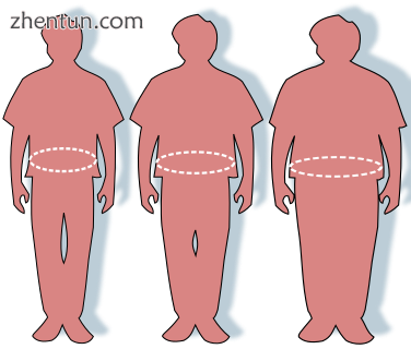 Silhouettes and waist circumferences representing optimal, overweight, and obese