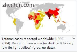 Tetanus cases reported worldwide (1990-2004). Ranging from some (in dark red) to.jpg