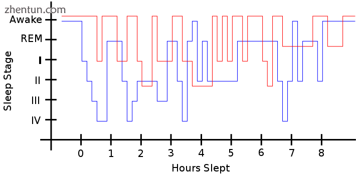 Sleep pattern of a person with restless legs syndrome (red) versus a healthy sle.png