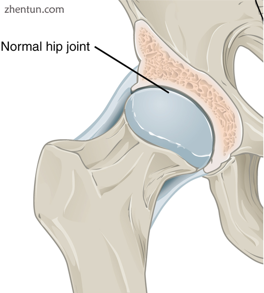 Healthy hip joint.png