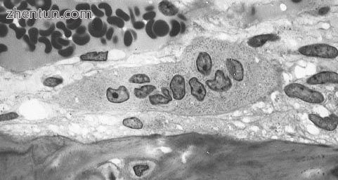 Osteoclast displaying many nuclei within its.jpg