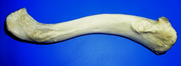 Right clavicle—from below, and from above1.jpg