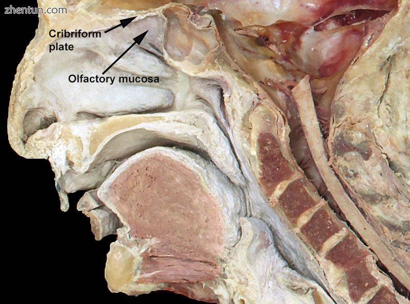 Head bisection showing location of olfactory mucosa and cribriform plate. Olfact.jpg