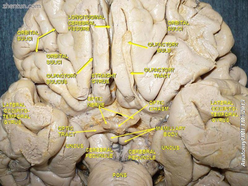 Olfactory nerve. Deep dissection. Inferior view..JPG