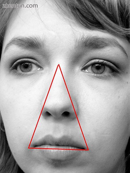 The danger triangle of the area from the corners of the mouth to the bridge of t.jpg