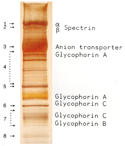 Red blood cell membrane proteins separated by SDS-PAGE and silverstained[29].jpg