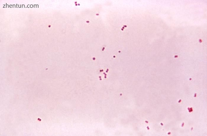Gram stain of meningococci from a culture showing Gram negative (pink) bacteria,.jpg