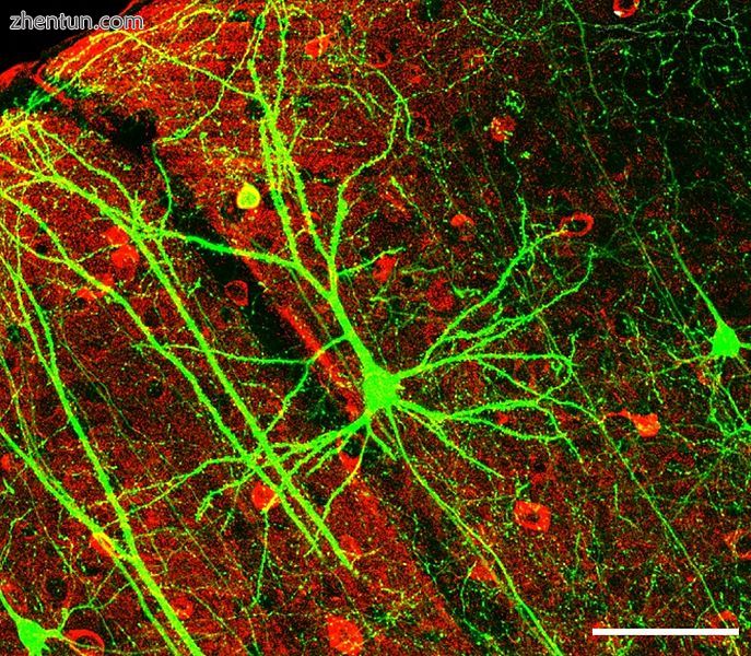 A network of dendrites from neurons in the hippocampus..jpg