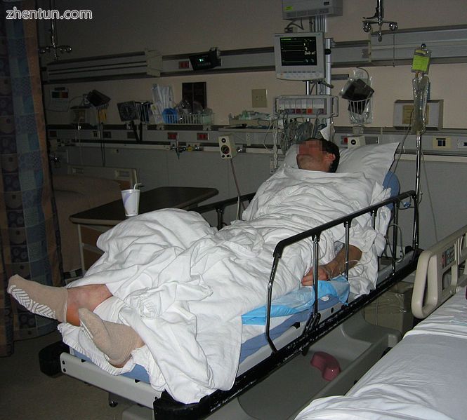 Anaesthetized patient in postoperative recovery..jpg