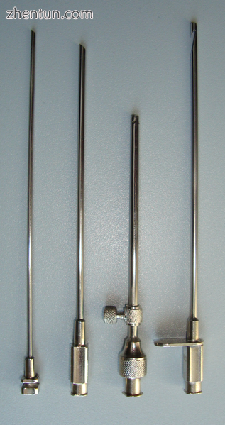 Instruments for thoracocentesis and needle biopsy of the pleura.[6].PNG