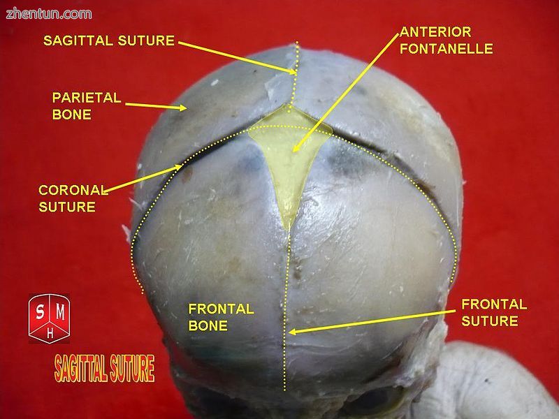 Sagittal suture..jpg