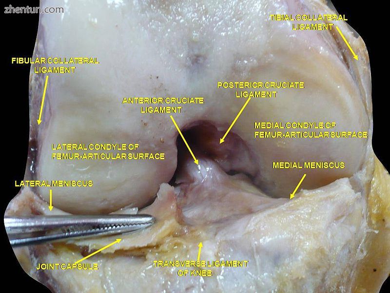 Anterior view of knee..JPG
