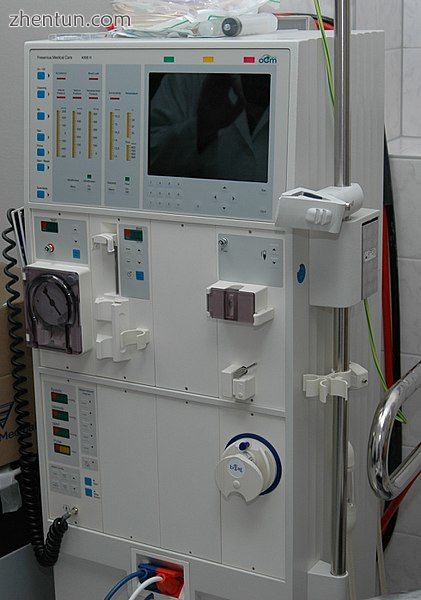 A hemodialysis machine which is used to replace the function of the kidneys.jpg