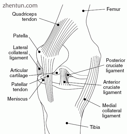 Anteromedial aspect of right knee.gif