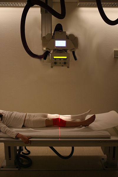 Radiography to examine eventual fractures after a knee injury.JPG