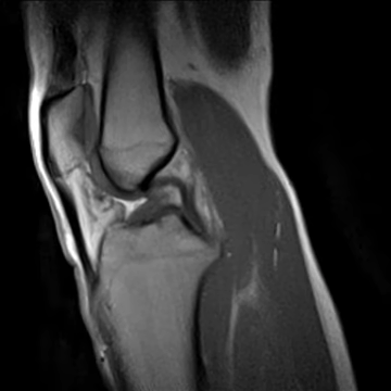 Real-time MRI- Knee.gif