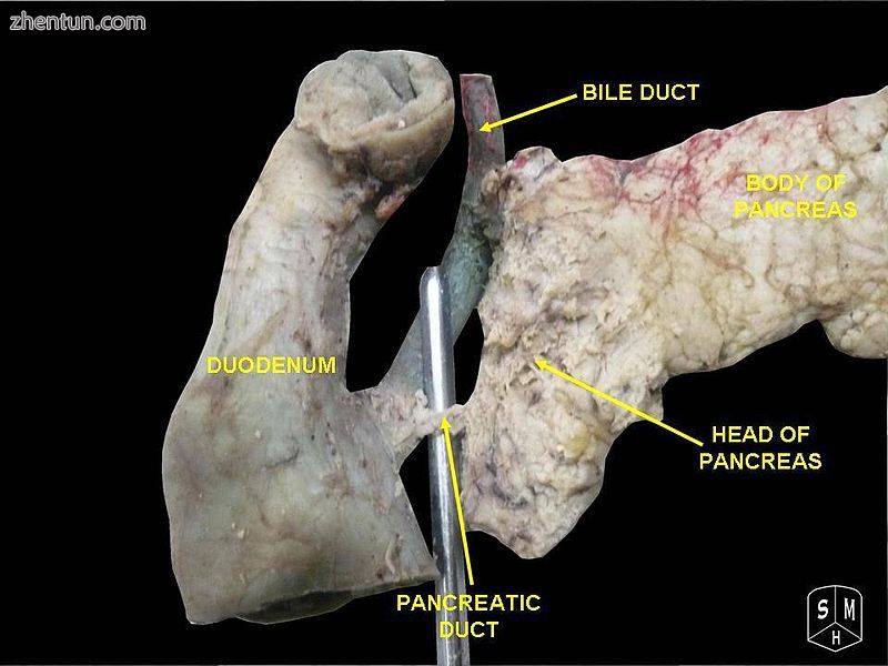 Bile duct.Deep dissection.Anterior view..JPG