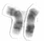 Chromosome 17.png