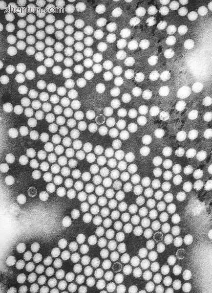 A TEM micrograph of poliovirus.PNG