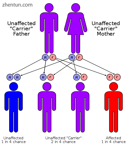 Gitelman syndrome has an autosomal recessive pattern of inheritance..png