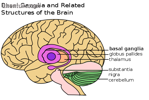 Location of the basal ganglia, the part of the brain affected by Wilson&#039;s disease.png