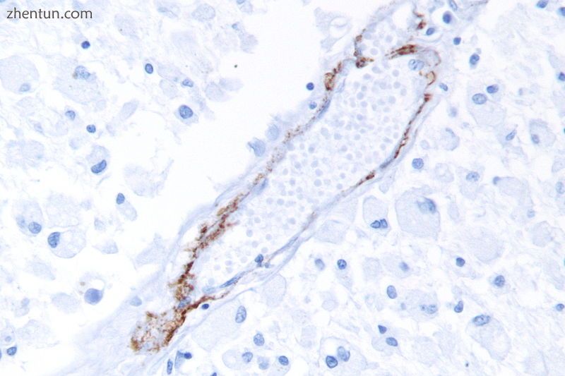 A micrograph showing punctate immunostaining (brown) with a Notch 3 antibody, as.jpg