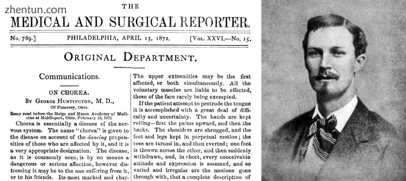 In 1872 George Huntington described the disorder in his first paper.jpg