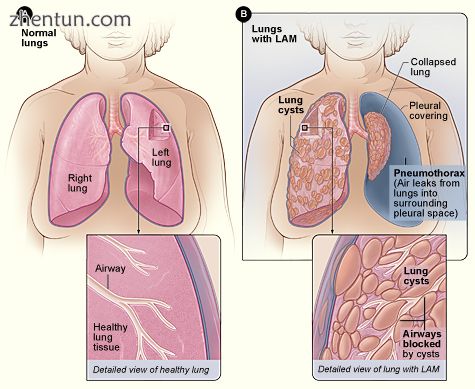 Figure A shows the location of the lungs and airways in.jpg