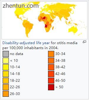 Disability-adjusted life year for otitis media per 100,000 inhabitants in 2004..jpg