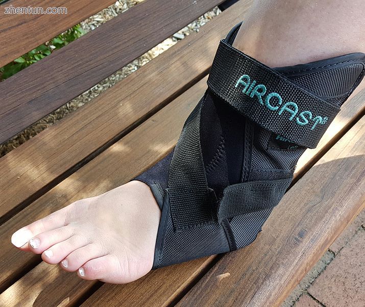 A brace offering moderate support and compression for a Grade I ankle sprain..jpg