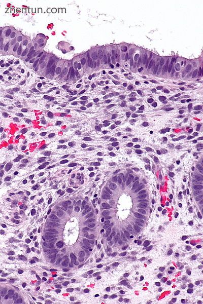 Endometrium in the proliferative phase.jpg