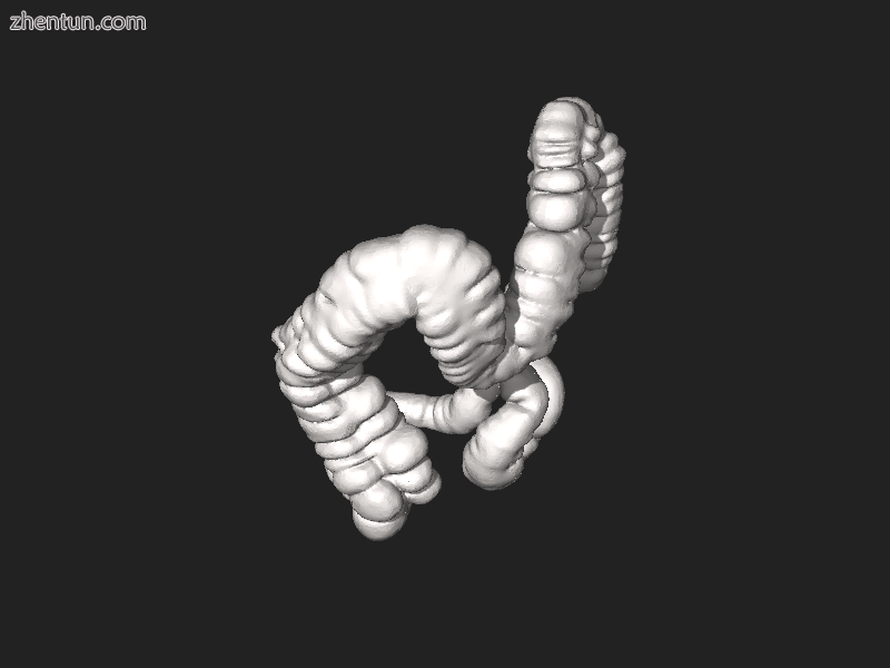 3D File generated from computed tomography of large intestine.png