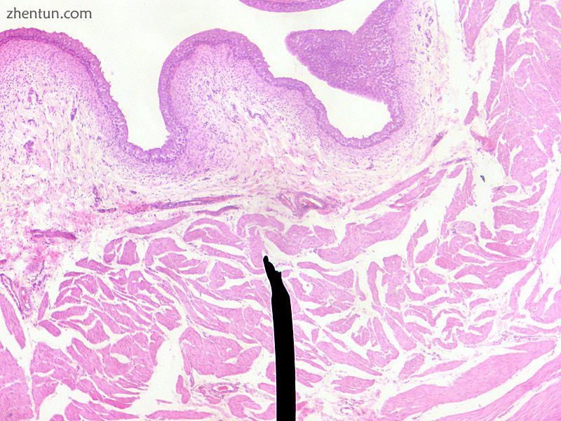 Layers of the urinary bladder wall and cross section of the detrusor muscle..JPG