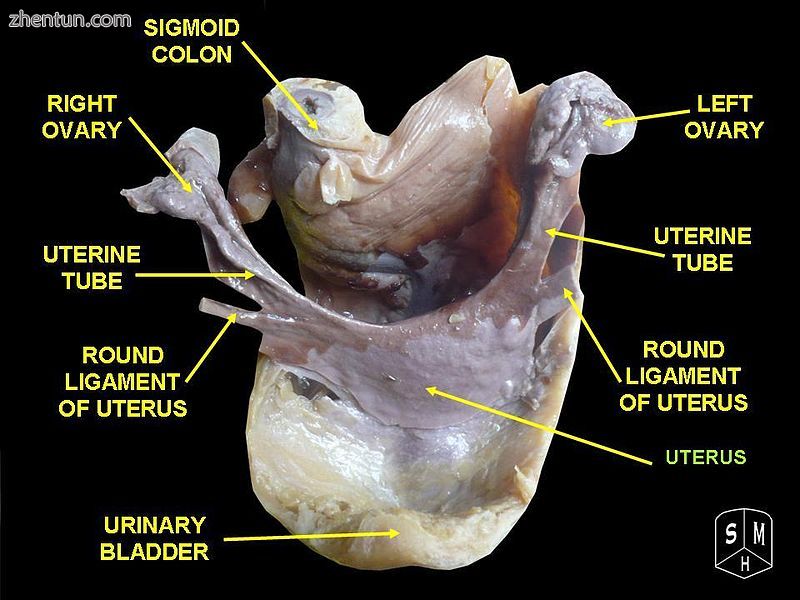 Uterus.JPG