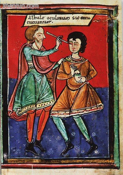 12th century medieval eye surgery in Italy.jpg