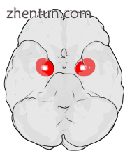 Location of the amygdalae in the human brain.png