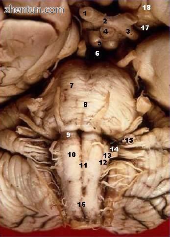 Medulla and parts (10-16) - (10) pyramid; (11) the anterior median fissure; (15).jpg