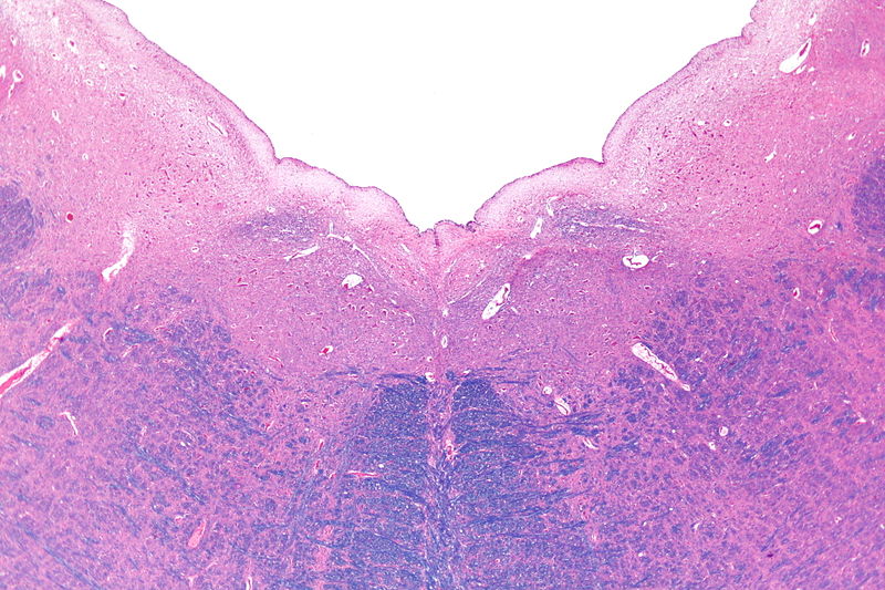 Micrograph of the posterior portion of the open part of the medulla oblongata, s.jpg