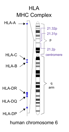 HLA region of Chromosome 6. Changes in this area increase the probability of get.png