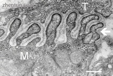Electron micrograph showing a cross section through the neuromuscular junction. .jpg