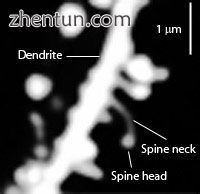 Dendritic spines on medium spiny neuron of striatum.jpg