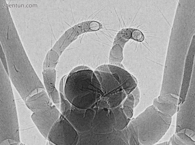 Phase-contrast x-ray image of spider.jpg