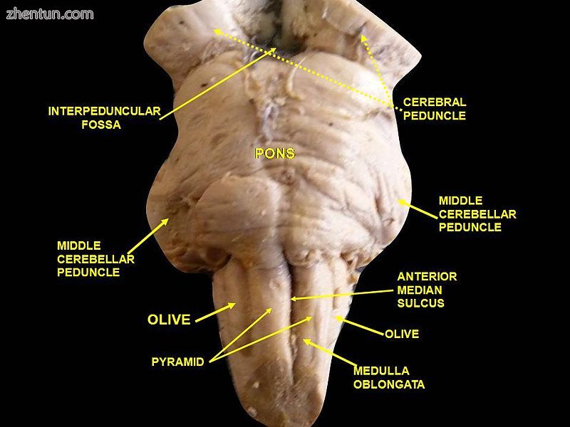 The appearance of a cadaveric brainstem from the front, with major parts labelled..JPG