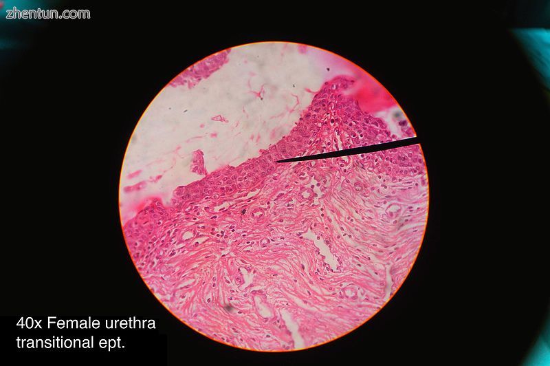 Histology of female urethra showing transitional epithelium.jpg