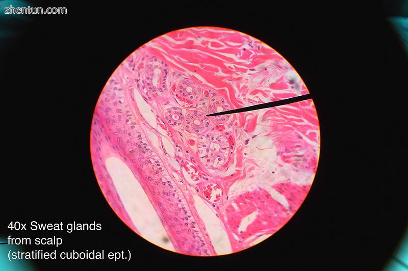 Histology of sweat gland showing stratified cuboidal epithelium.jpg