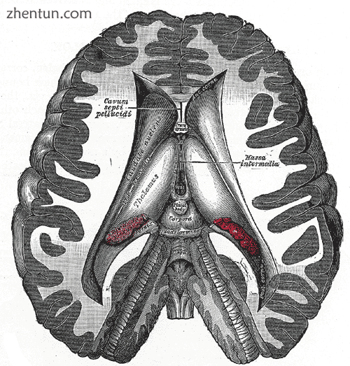 Transverse dissection showing the ventricles of the brain..png