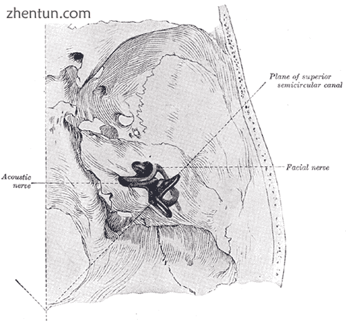 Position of the right bony labyrinth of the ear in the skull, viewed from above..png