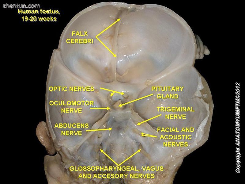 Vestibulocochlear nerve.JPG